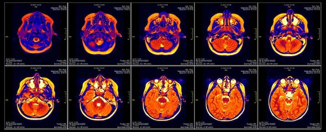 Back-to-Basics Weekend Reading: Twenty years of functional MRI